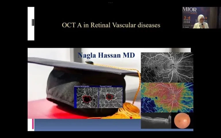 OCT Angiography in retinal vascular diseases