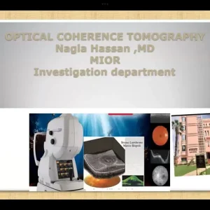 Optical Coherence Tomography